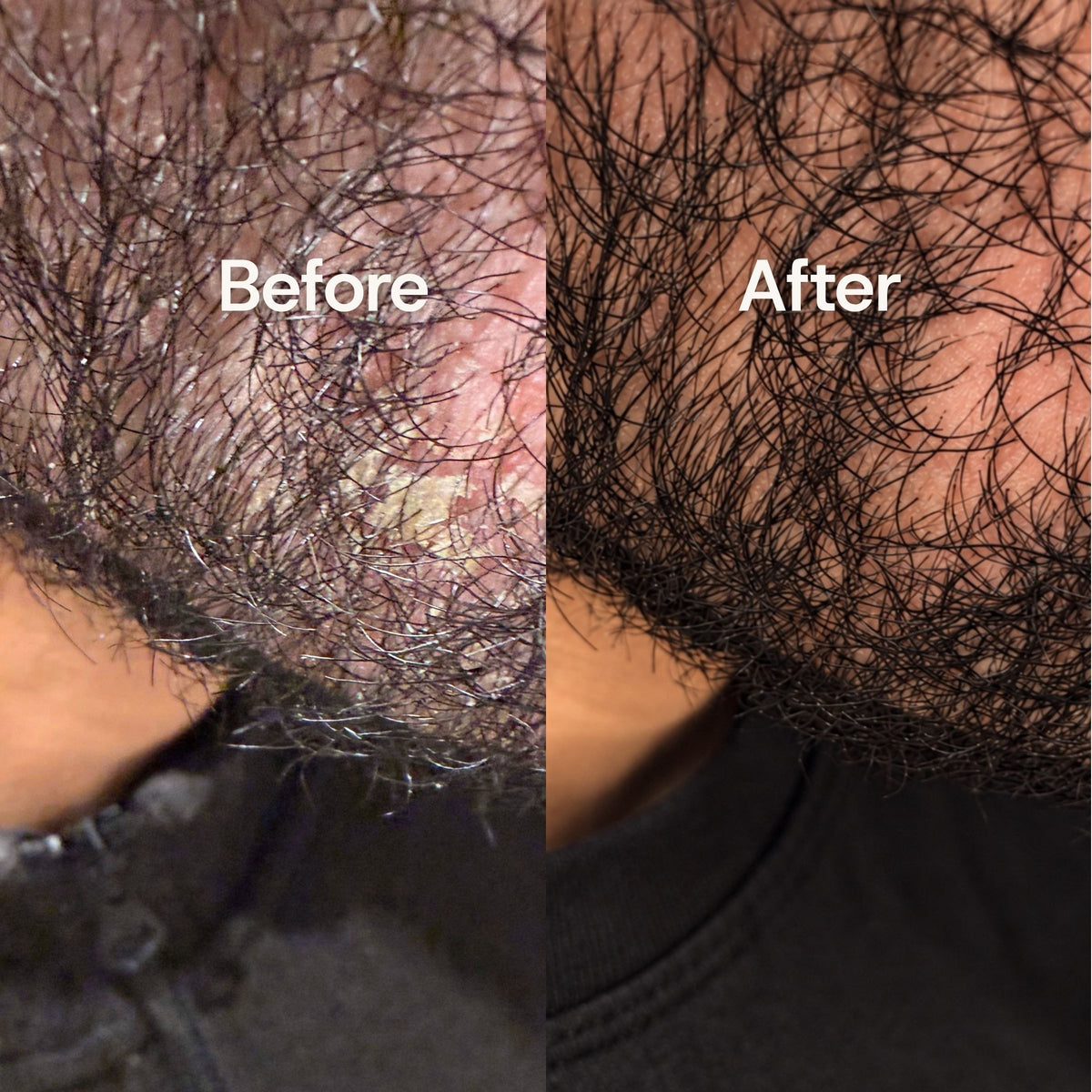 Beard and jawline