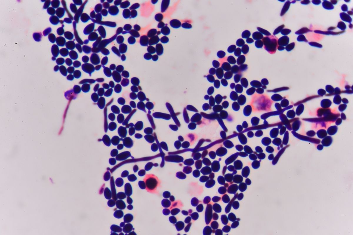 Understanding Malassezia: The Fungus Behind Seborrheic Dermatitis